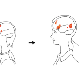 Streckbild, två unga personer med områden i hjärnan färglagda.