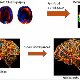 MRE, AI and Brain development. Digital Futures, KTH